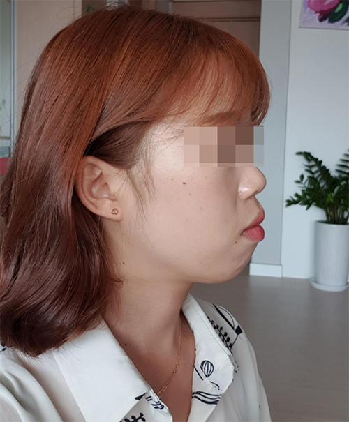 before%2B%25285%2529_-.jpg