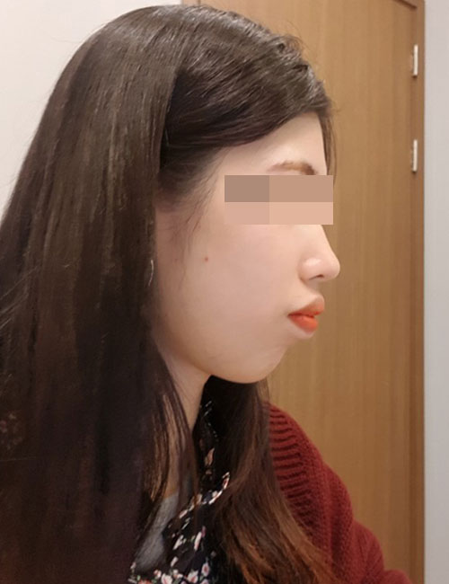 B2.jpg