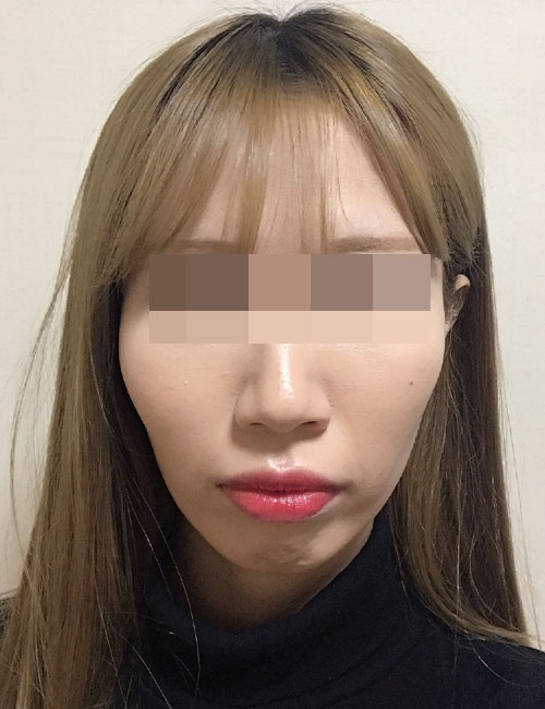 B.jpg