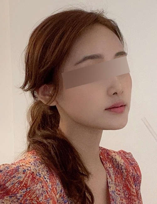 B.jpg