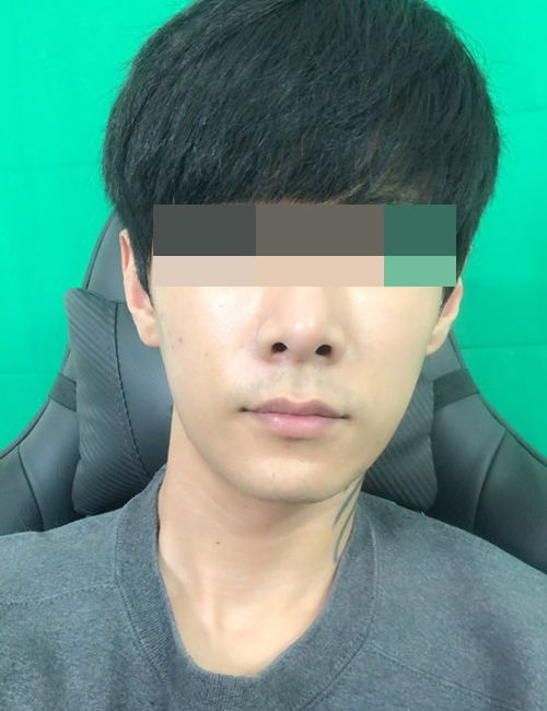 210.png