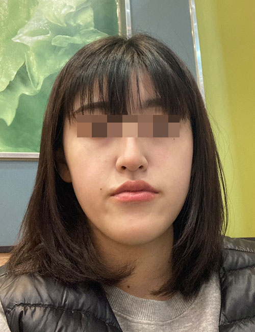 B.jpg