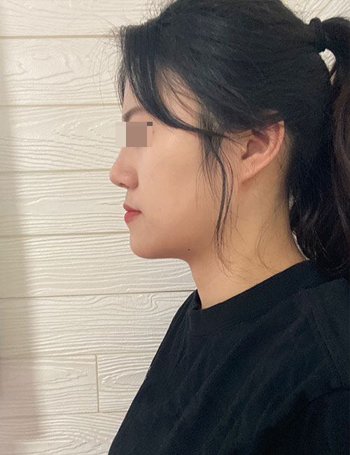 B.jpg