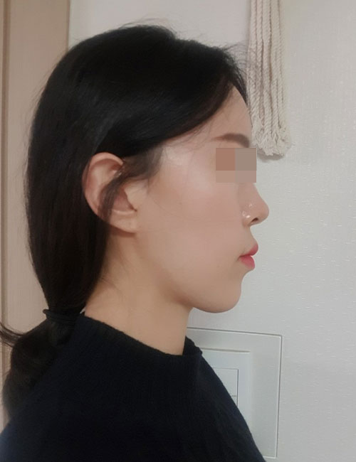 B.jpg