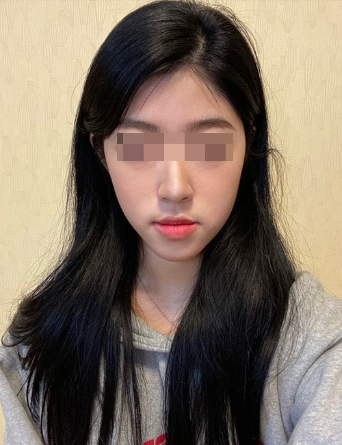 B.jpg