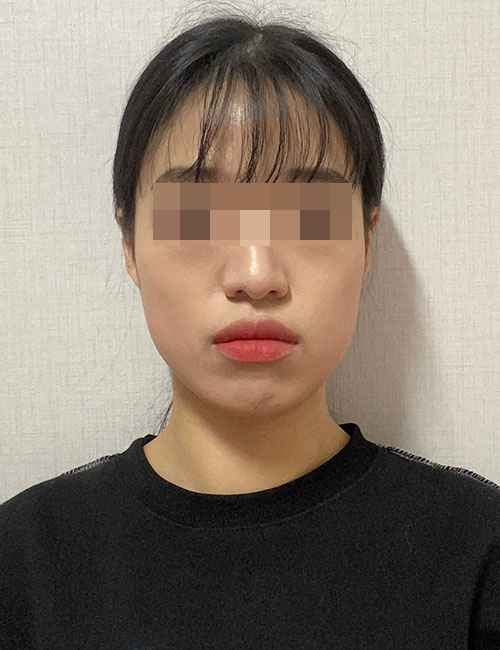 B.jpg