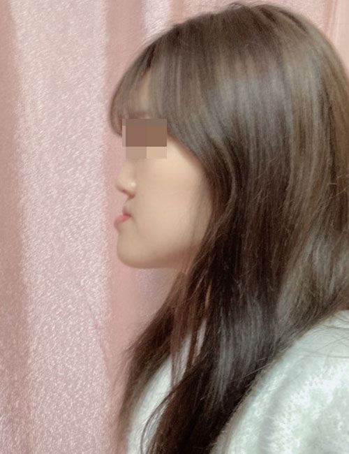 B2.jpg