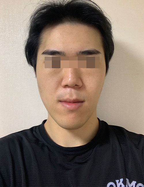 B.jpg