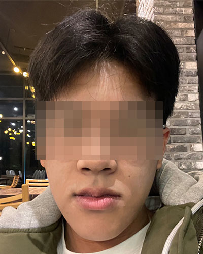 Before-%25282%2529.jpg