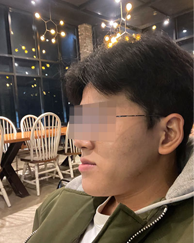 Before-%252811%2529.jpg