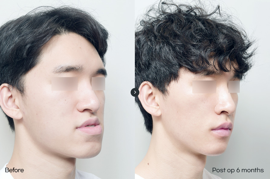 전후사진남자