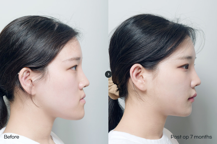 전후사진남자