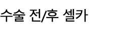 전후사진